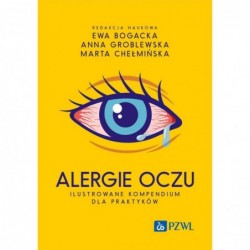 Alergie oczu. Ilustrowane...