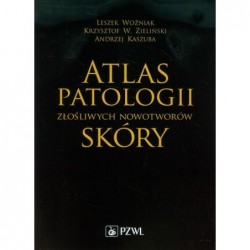 Atlas patologii złośliwych...