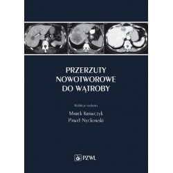 Przerzuty nowotworowe do...