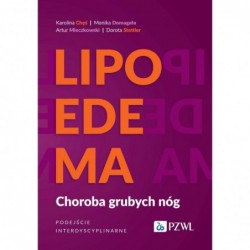 Lipoedema. Choroba grubych...