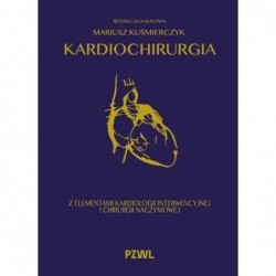 Kardiochirurgia z...