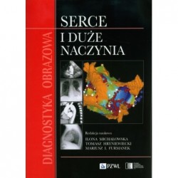 Diagnostyka obrazowa Serce...