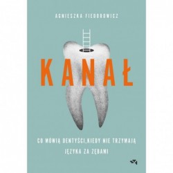 Kanał. Co mówią dentyści,...
