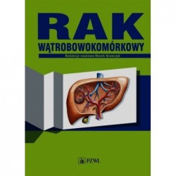Rak wątrobowokomórkowy