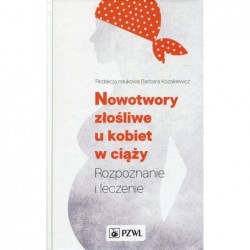 Nowotwory złośliwe u kobiet...