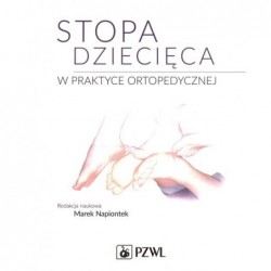 Stopa dziecięca w praktyce...