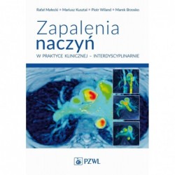 Zapalenia naczyń – w...
