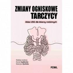Zmiany ogniskowe tarczycy....