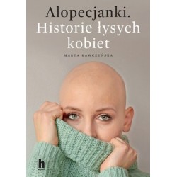 Alopecjanki. Historie...