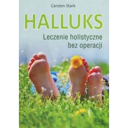 Halluks. Leczenie...